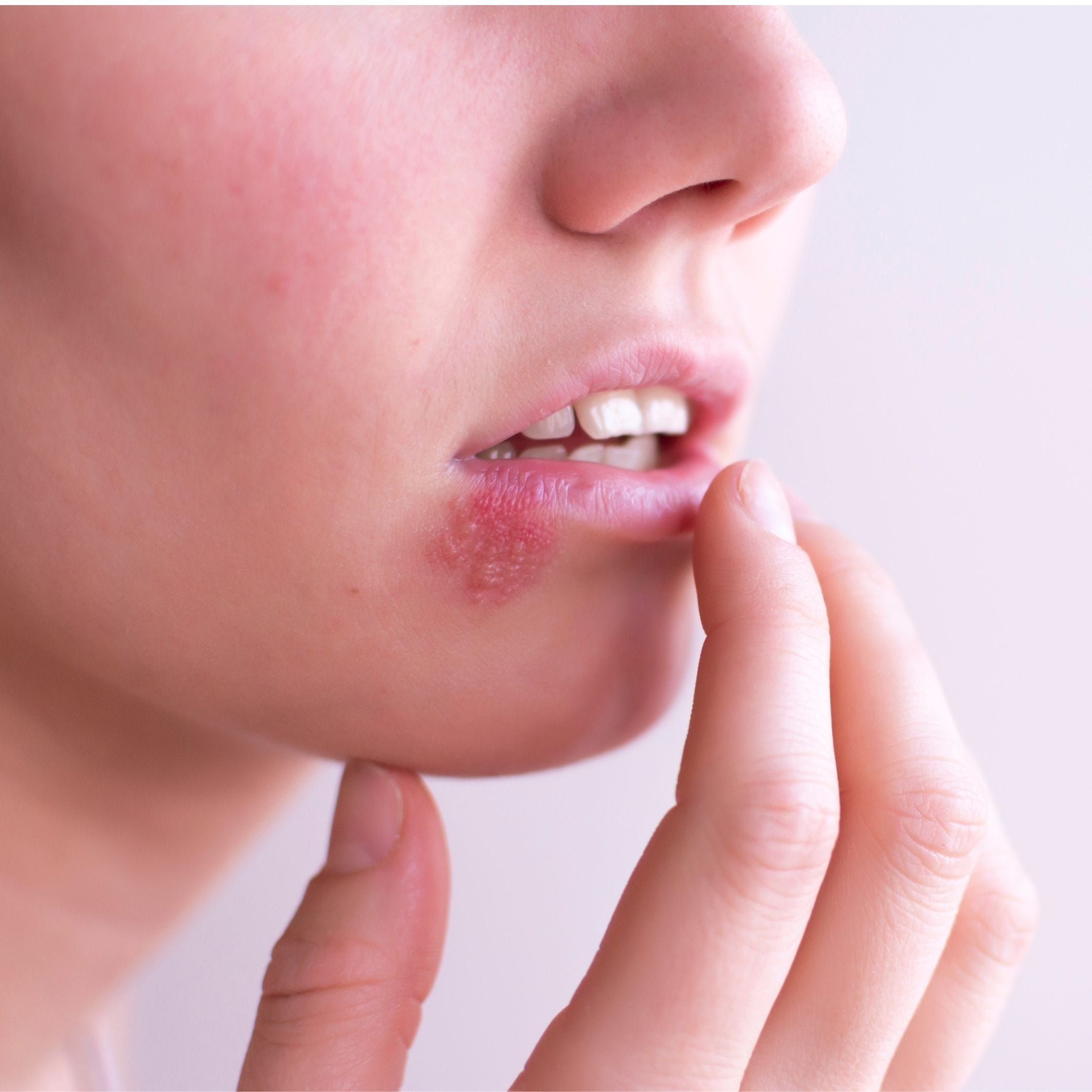 Black Currant Cold-Pressed Oil (Ribes Nigrum)